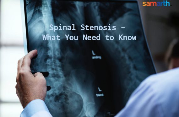 It’s Good To Know About Spinal Stenosis
