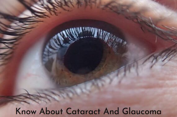 Know About Cataract And Glaucoma