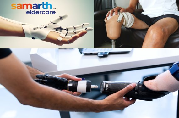Prosthetics